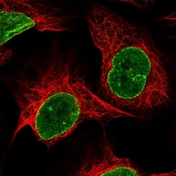 RNF6 Antibody, Novus Biologicals 0.1mL; Unlabeled:Antibodies, Polyclonal